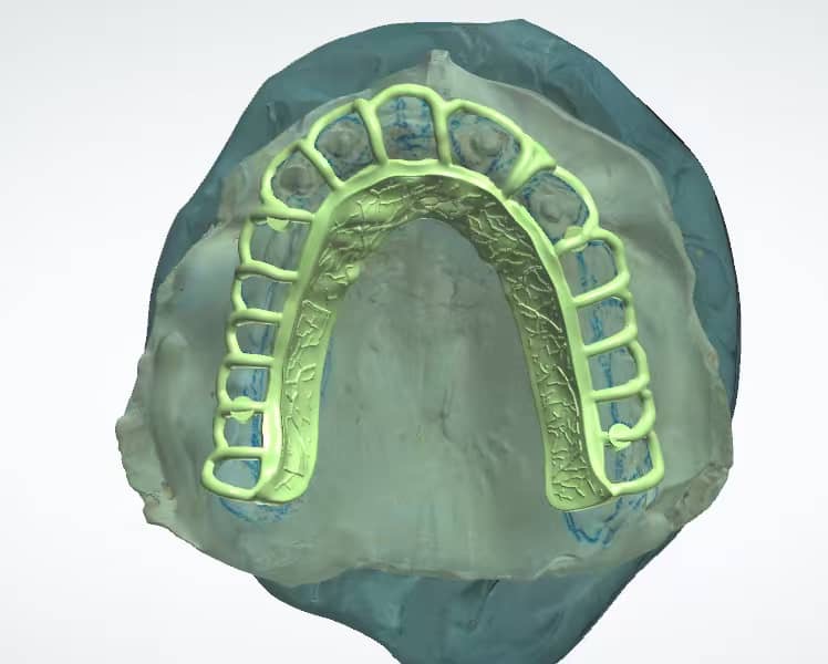 Digital dentistry workflow